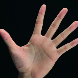 手掌之内有乾坤---掌纹告诉你身体怎么了？